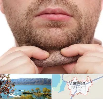 ساکشن غبغب در مریوان