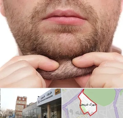 ساکشن غبغب در شهرک شریعتی