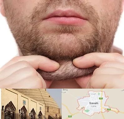 ساکشن غبغب در ساوه