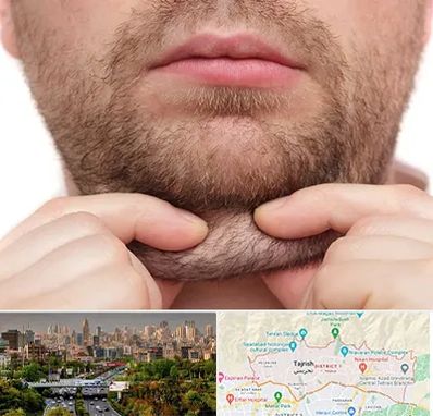 ساکشن غبغب در منطقه 1 تهران 