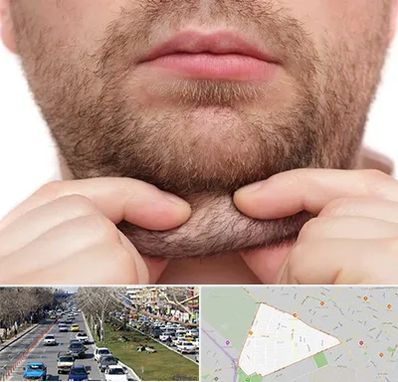 ساکشن غبغب در احمدآباد مشهد 