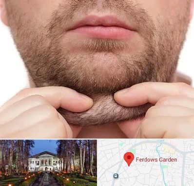 ساکشن غبغب در باغ فردوس