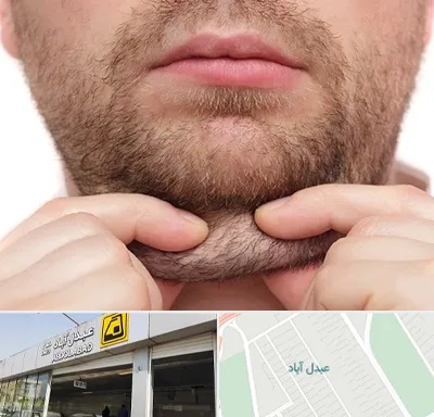 ساکشن غبغب در عبدل آباد