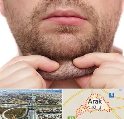 ساکشن غبغب در اراک