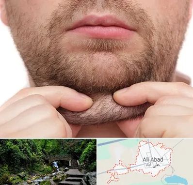 ساکشن غبغب در علی‌ آباد کتول