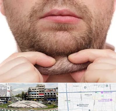 ساکشن غبغب در مرکز تهران