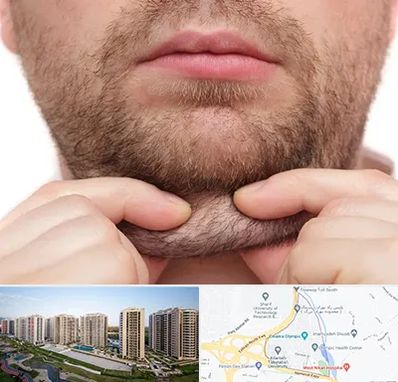 ساکشن غبغب در المپیک 