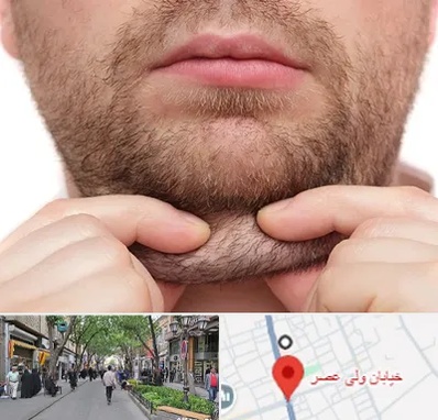 ساکشن غبغب در ولیعصر شهریار