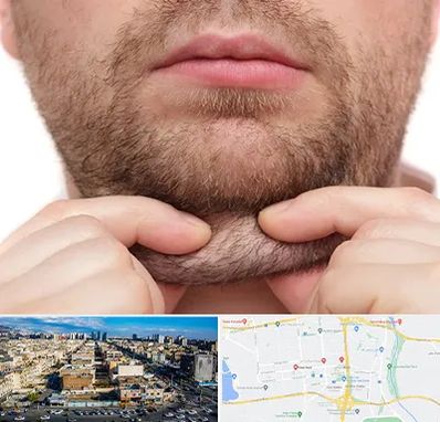 ساکشن غبغب در شهرک راه آهن 