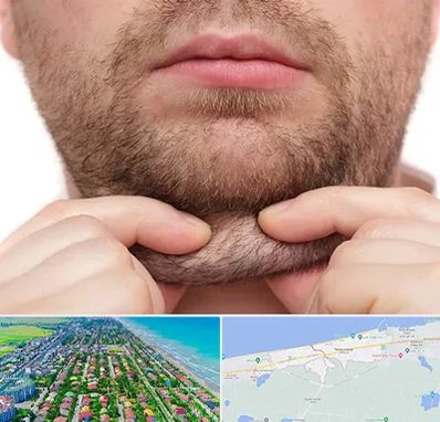 ساکشن غبغب در فریدونکنار