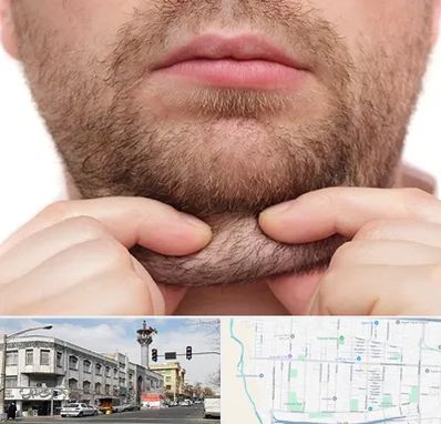 ساکشن غبغب در 17شهریور