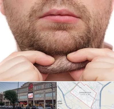 ساکشن غبغب در قائمیه اسلامشهر