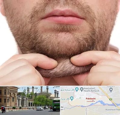 ساکشن غبغب در پاکدشت