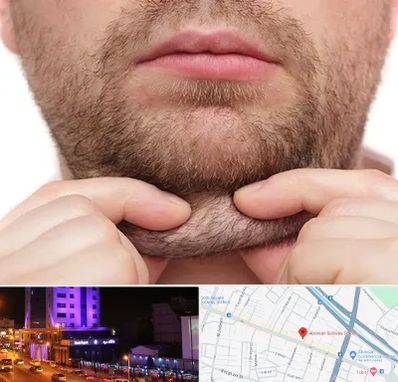 ساکشن غبغب در آبرسان تبریز