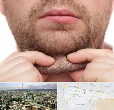 ساکشن غبغب در منطقه 8 تهران