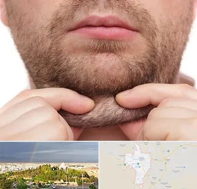 ساکشن غبغب در تربت حیدریه