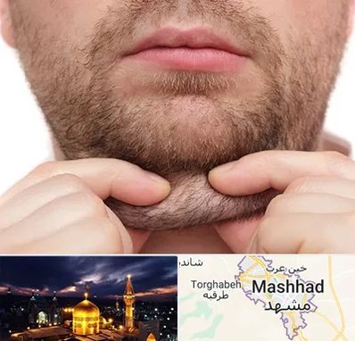 ساکشن غبغب در مشهد