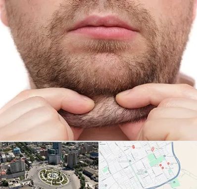 ساکشن غبغب در زرافشان اسلامشهر