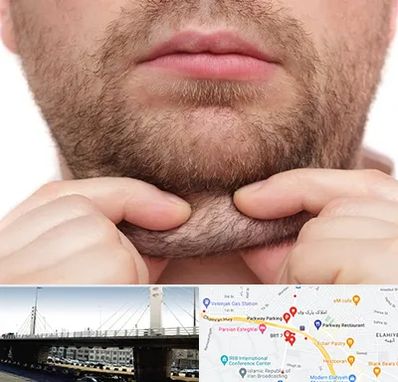 ساکشن غبغب در پارک وی 