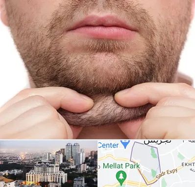 ساکشن غبغب در الهیه 