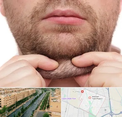 ساکشن غبغب در فاز سه اندیشه