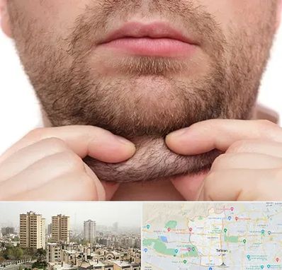 ساکشن غبغب در منطقه 5 تهران 