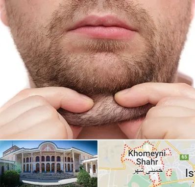 ساکشن غبغب در خمینی شهر