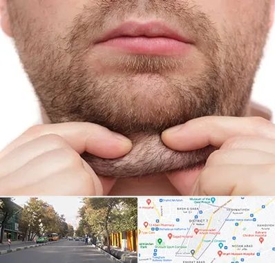 ساکشن غبغب در شریعتی 