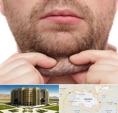 ساکشن غبغب در نجف آباد