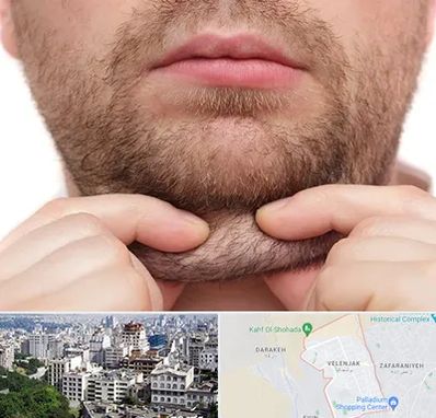 ساکشن غبغب در ولنجک 