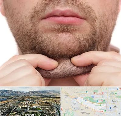 ساکشن غبغب در منطقه 21 تهران 