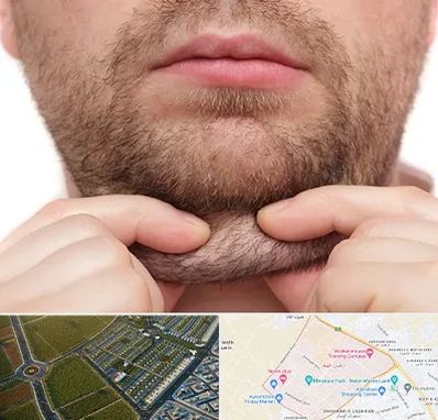 ساکشن غبغب در الهیه مشهد 