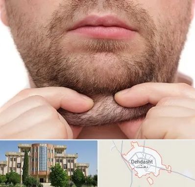 ساکشن غبغب در دهدشت