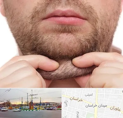 ساکشن غبغب در میدان خراسان