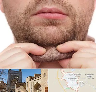 ساکشن غبغب در تربت جام