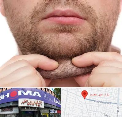 ساکشن غبغب در امین حضور