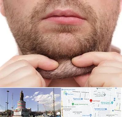 ساکشن غبغب در کارگر جنوبی 