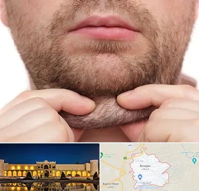 ساکشن غبغب در برازجان