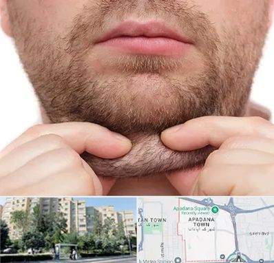 ساکشن غبغب در آپادانا