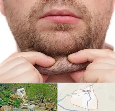 ساکشن غبغب در کردان
