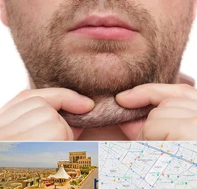 ساکشن غبغب در هاشمیه مشهد 