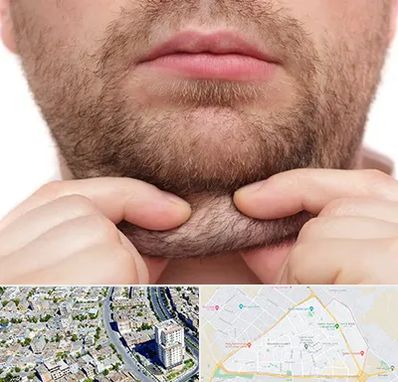 ساکشن غبغب در قاسم آباد مشهد 