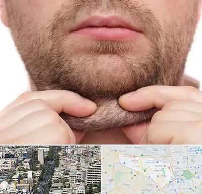 ساکشن غبغب در منطقه 18 تهران
