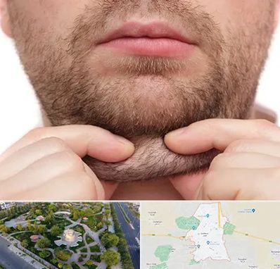 ساکشن غبغب در کاشمر