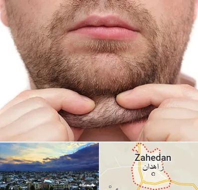 ساکشن غبغب در زاهدان