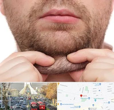 ساکشن غبغب در خیابان آزادی 