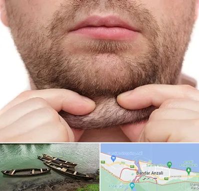 ساکشن غبغب در بندر انزلی