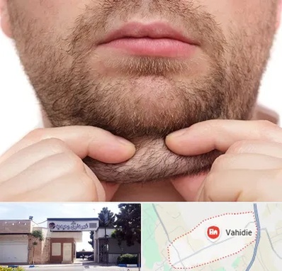 ساکشن غبغب در وحیدیه شهریار