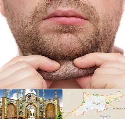 ساکشن غبغب در سمنان