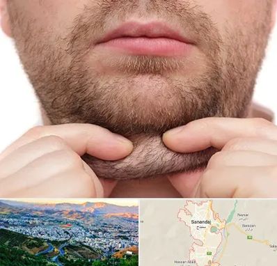 ساکشن غبغب در سنندج